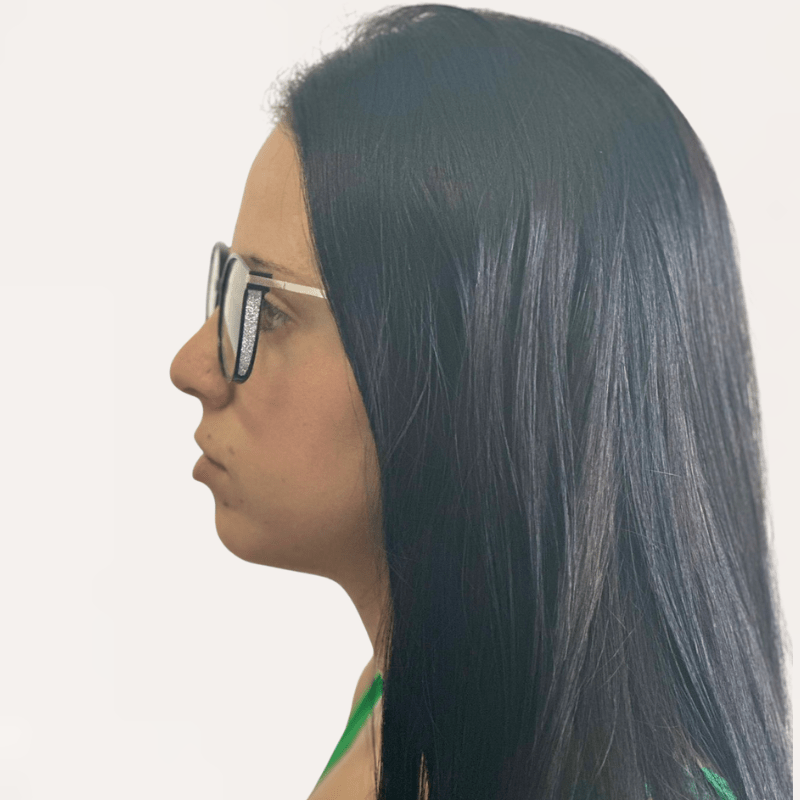 Crystal Elite Vision – Multifocal Glasses with Free Gifts - ALPINE WEAR